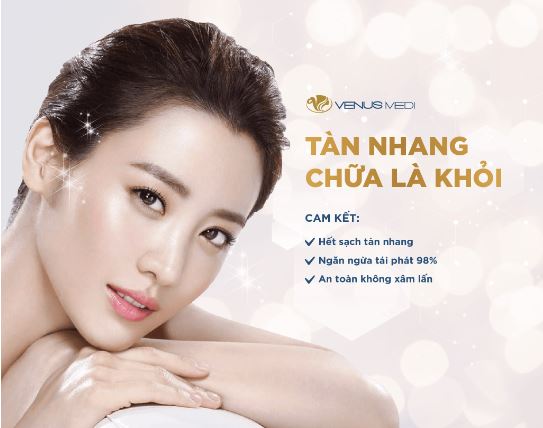 laser trị tàn nhang